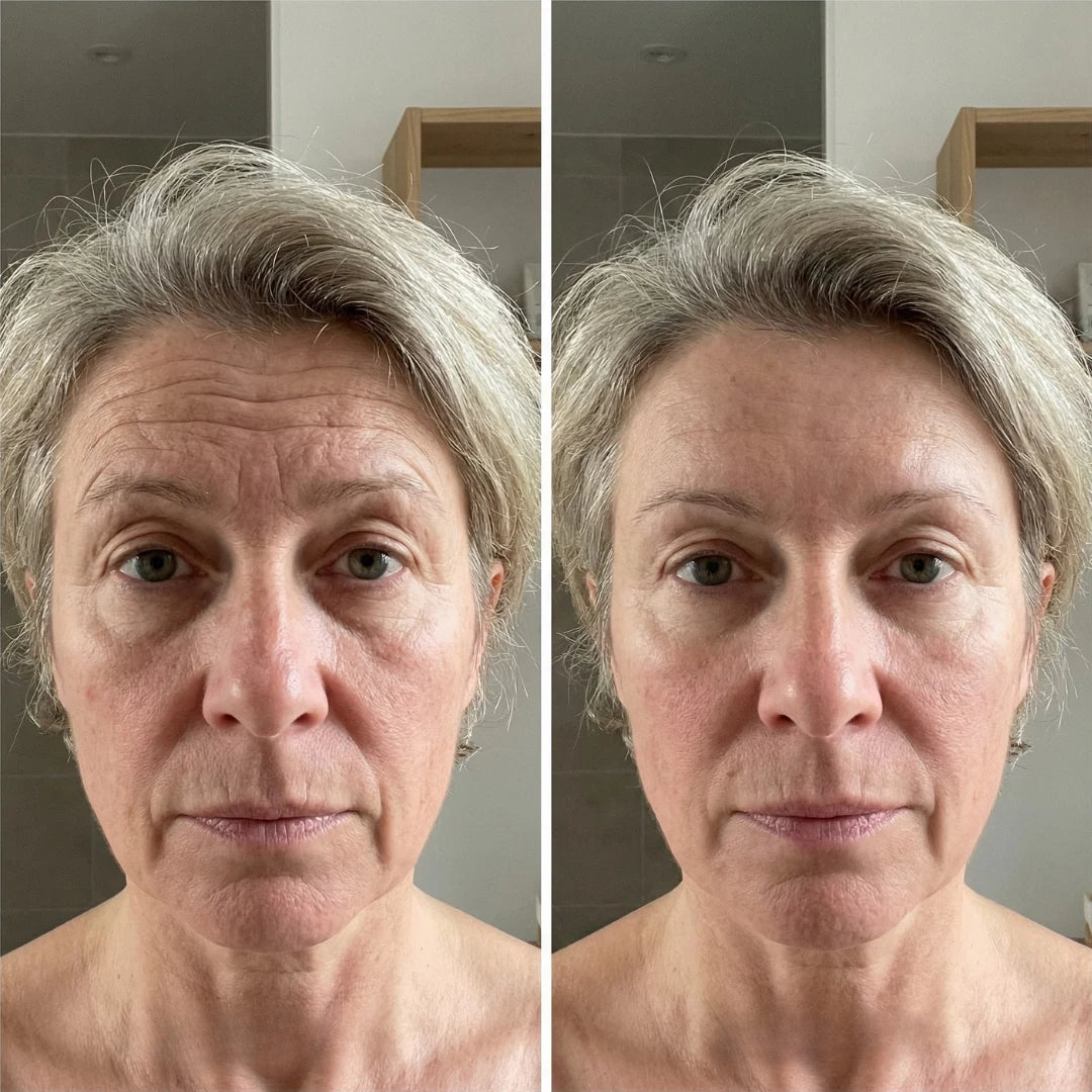 Avant et après sur le visage